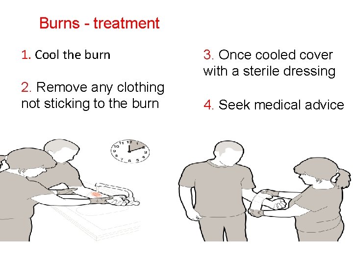 Burns - treatment 1. Cool the burn 2. Remove any clothing not sticking to