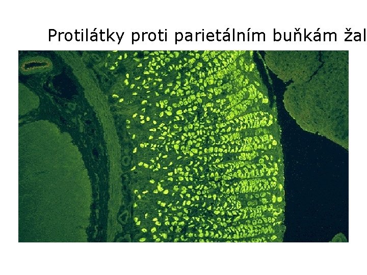 Protilátky proti parietálním buňkám žalu 