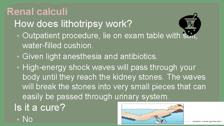 Renal calculi ⦿How does lithotripsy work? • Outpatient procedure, lie on exam table with