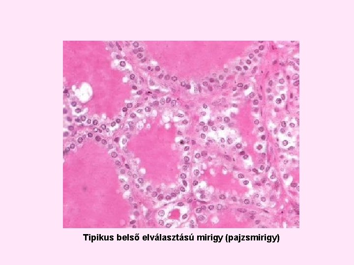 Tipikus belső elválasztású mirigy (pajzsmirigy) Tipikus belső elválasztású mirigy (pajzsmirigy)