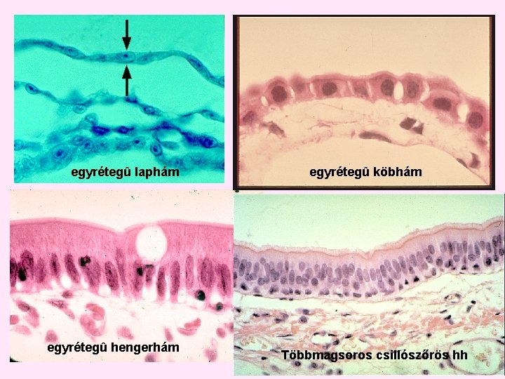 egyrétegû laphám egyrétegû hengerhám egyrétegû köbhám Többmagsoros csillószőrös hh egyrétegû laphám egyrétegû hengerhám egyrétegû köbhám Többmagsoros csillószőrös hh