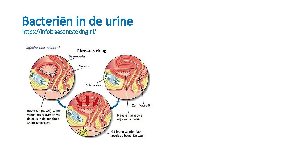 Bacteriën in de urine https: //infoblaasontsteking. nl/ 