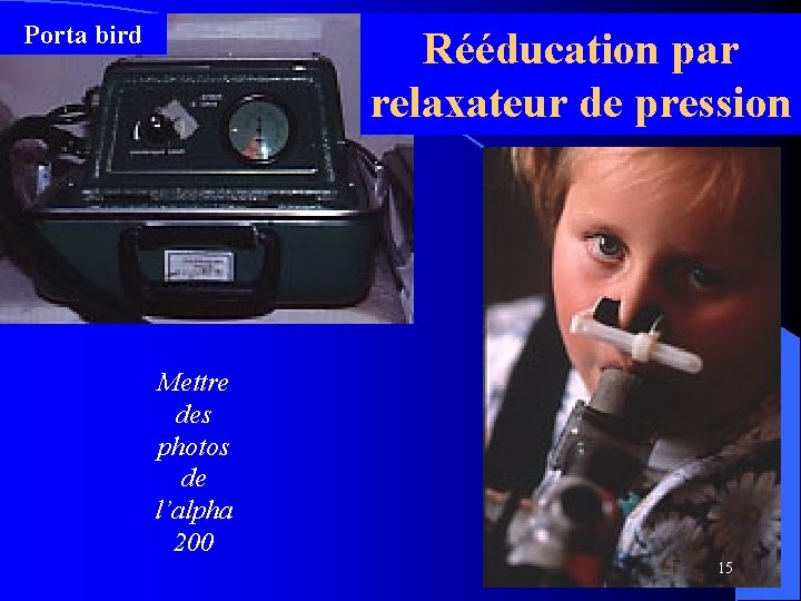 Porta bird Rééducation par relaxateur de pression Mettre des photos de l’alpha 200 15