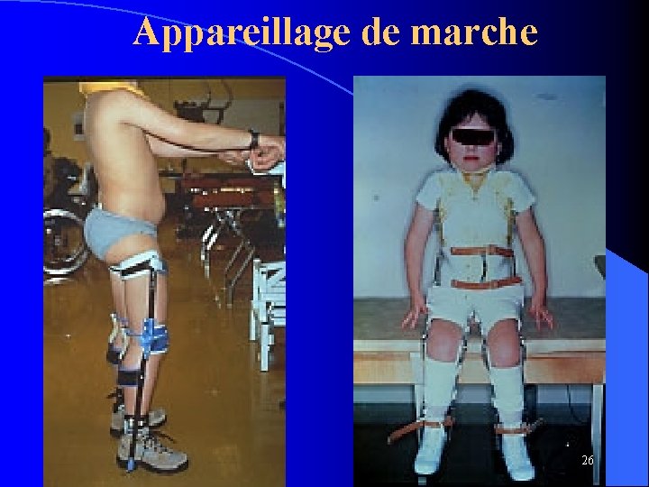 Appareillage de marche 26 