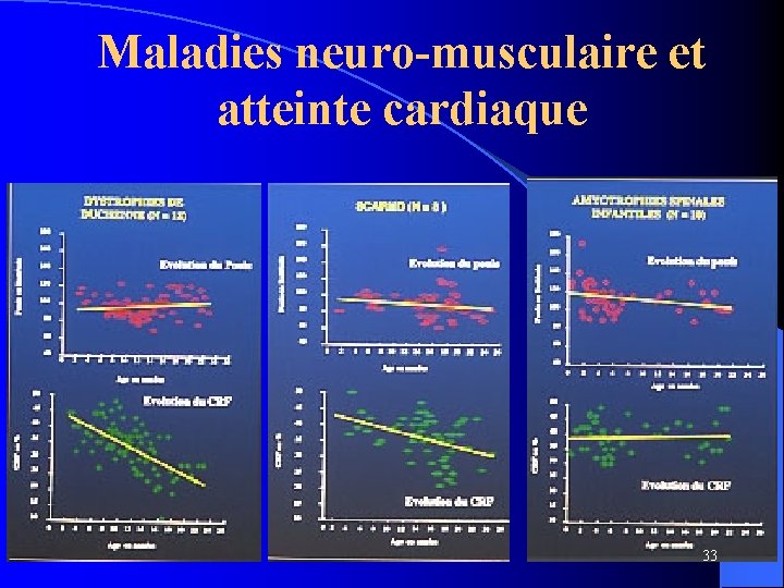 Maladies neuro-musculaire et atteinte cardiaque 33 