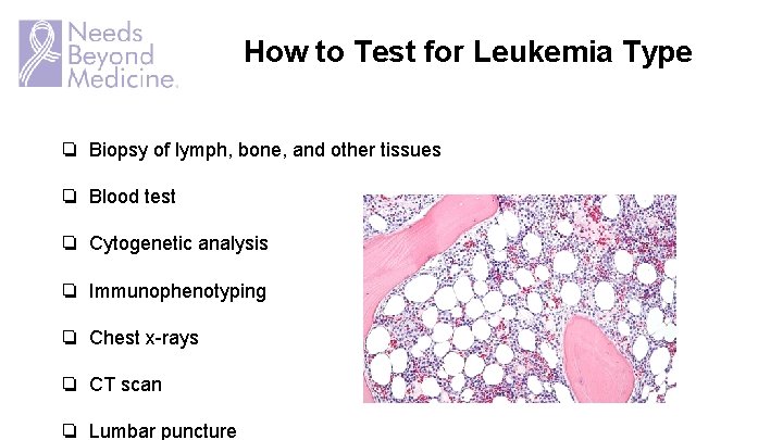 How to Test for Leukemia Type ❏ Biopsy of lymph, bone, and other tissues