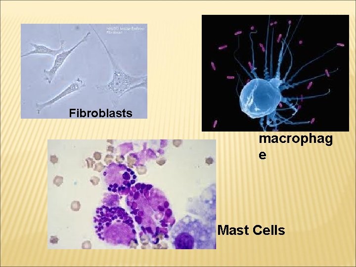 Fibroblasts macrophag e Mast Cells 