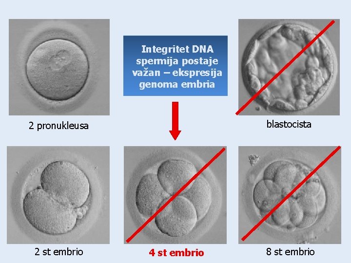 Integritet DNA spermija postaje važan – ekspresija genoma embria blastocista 2 pronukleusa 2 st