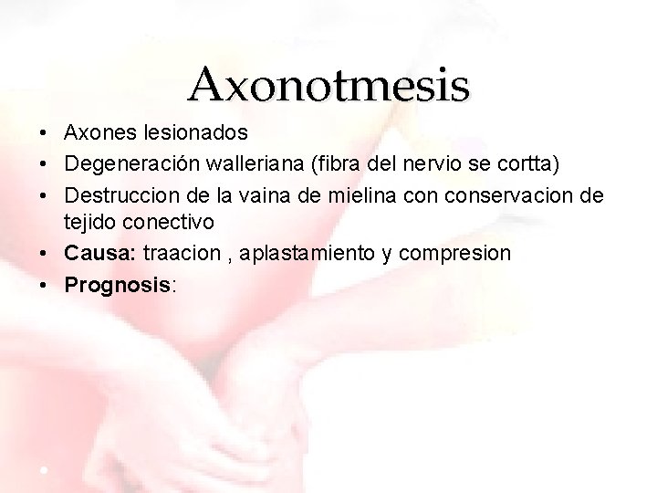 Axonotmesis • Axones lesionados • Degeneración walleriana (fibra del nervio se cortta) • Destruccion