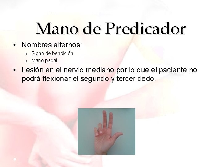 Mano de Predicador • Nombres alternos: o Signo de bendición o Mano papal •