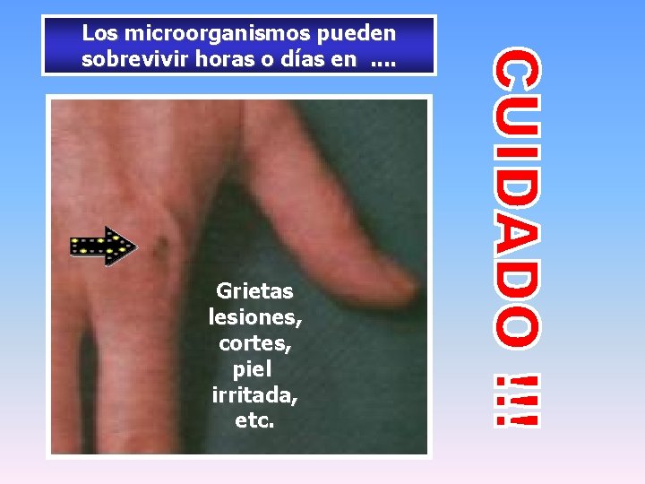 Los microorganismos pueden sobrevivir horas o días en. . Grietas lesiones, cortes, piel irritada,