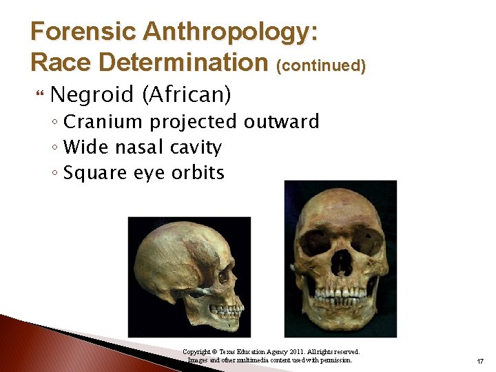 Forensic Anthropology: Race Determination (continued) Negroid (African) ◦ Cranium projected outward ◦ Wide nasal