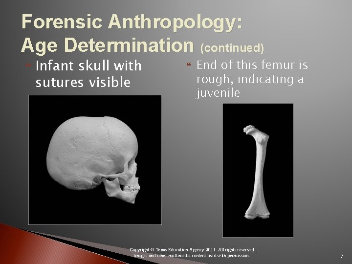 Forensic Anthropology: Age Determination (continued) Infant skull with sutures visible End of this femur