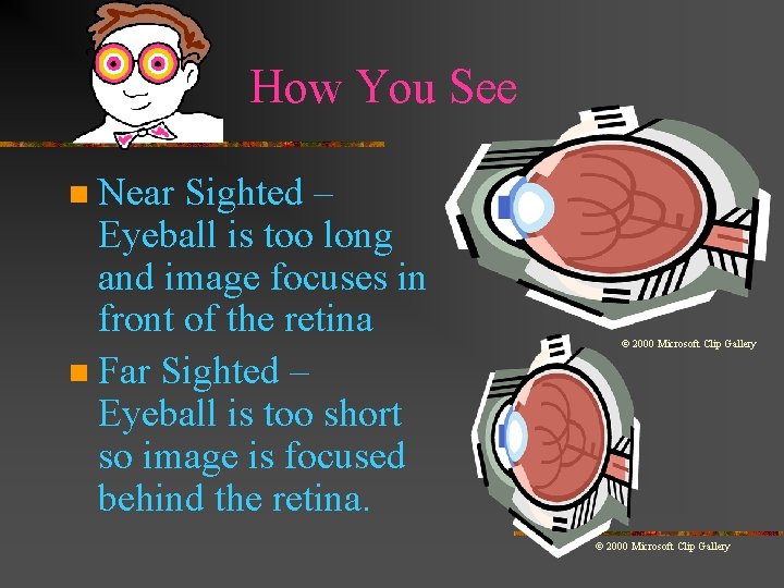 How You See Near Sighted – Eyeball is too long and image focuses in How You See Near Sighted – Eyeball is too long and image focuses in