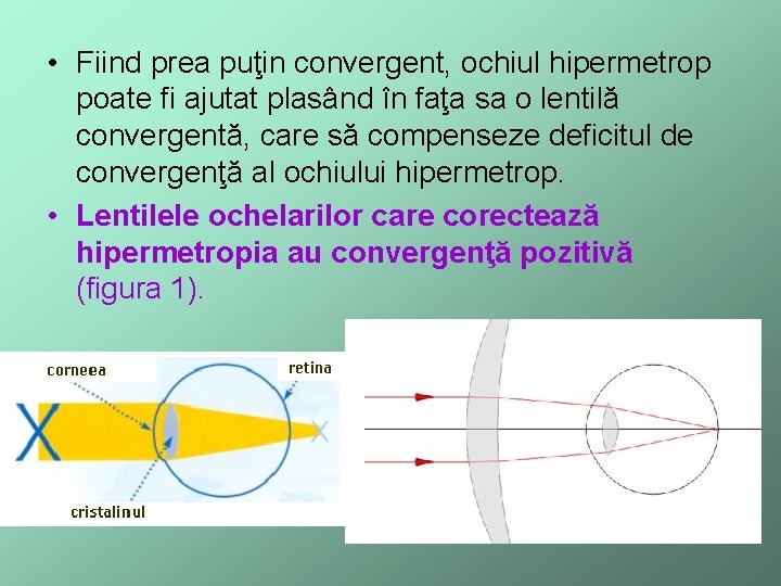  • Fiind prea puţin convergent, ochiul hipermetrop poate fi ajutat plasând în faţa