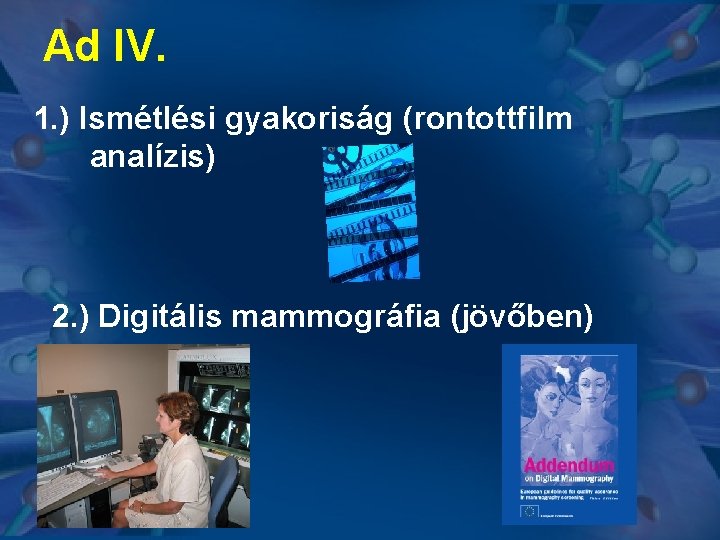 Ad IV. 1. ) Ismétlési gyakoriság (rontottfilm analízis) 2. ) Digitális mammográfia (jövőben) 