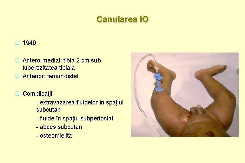 Canularea IO q 1940 q Antero-medial: tibia 2 cm sub tuberozitatea tibială q Anterior: