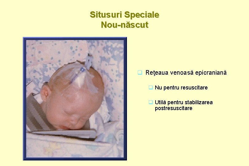 Situsuri Speciale Nou-născut q Reţeaua venoasă epicraniană q Nu pentru resuscitare q Utilă pentru