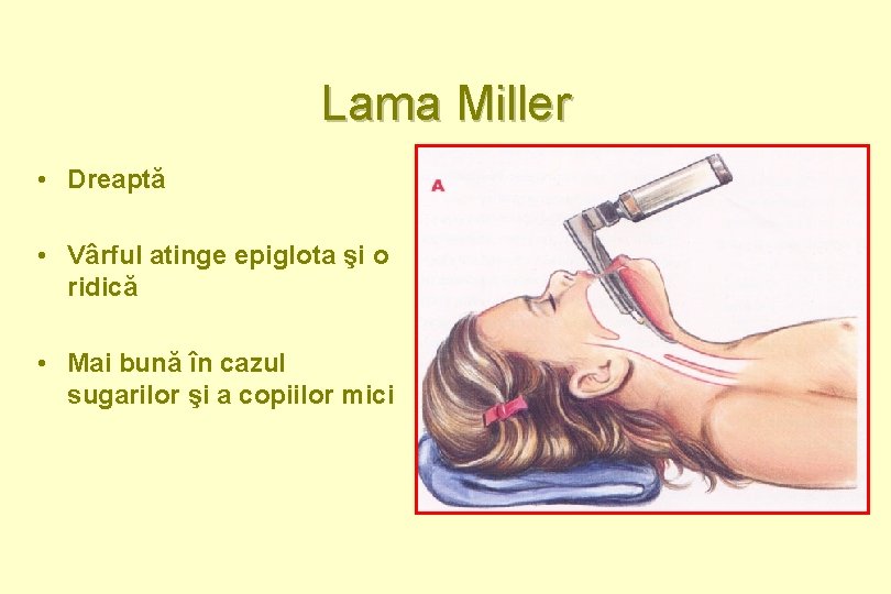 Lama Miller • Dreaptă • Vârful atinge epiglota şi o ridică • Mai bună