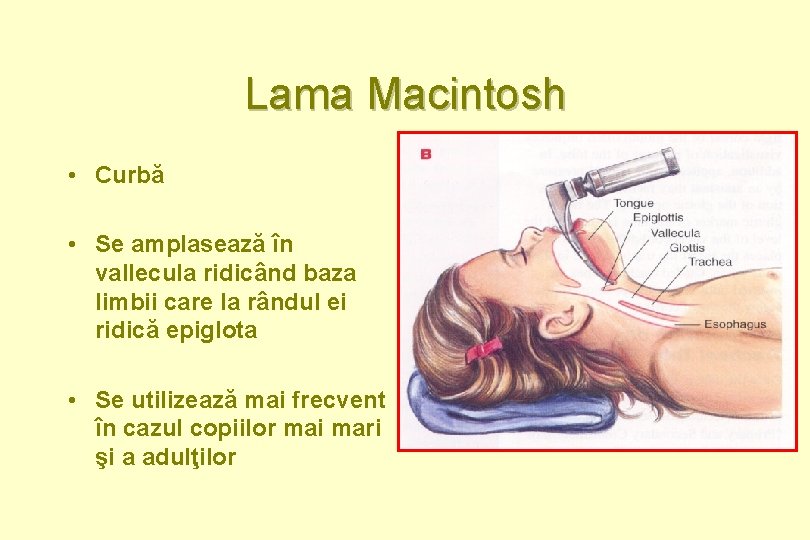 Lama Macintosh • Curbă • Se amplasează în vallecula ridicând baza limbii care la