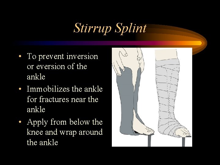 Stirrup Splint • To prevent inversion or eversion of the ankle • Immobilizes the
