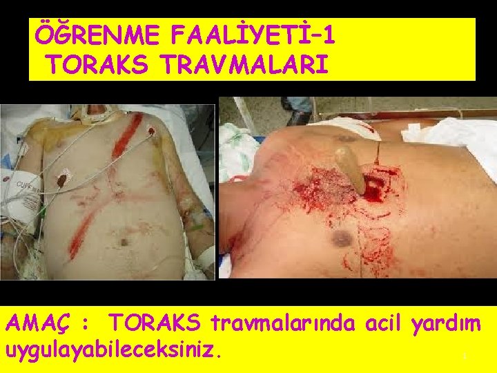 ÖĞRENME FAALİYETİ– 1 TORAKS TRAVMALARI AMAÇ : TORAKS travmalarında acil yardım uygulayabileceksiniz. 1 ÖĞRENME FAALİYETİ– 1 TORAKS TRAVMALARI AMAÇ : TORAKS travmalarında acil yardım uygulayabileceksiniz. 1