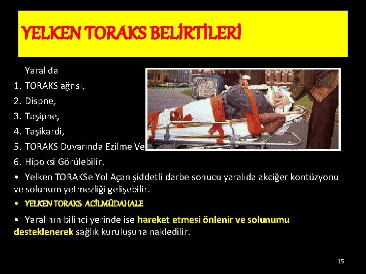 YELKEN TORAKS BELİRTİLERİ Yaralıda 1. TORAKS ağrısı, 2. Dispne, 3. Taşipne, 4. Taşikardi, 5. YELKEN TORAKS BELİRTİLERİ Yaralıda 1. TORAKS ağrısı, 2. Dispne, 3. Taşipne, 4. Taşikardi, 5.