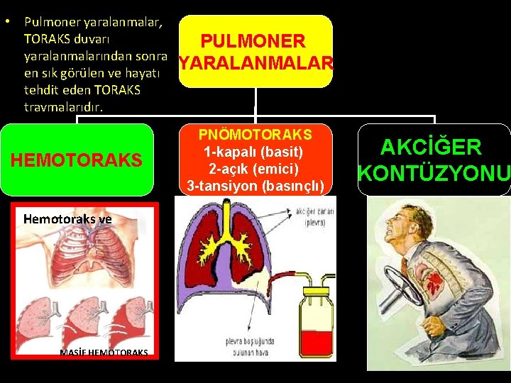 • Pulmoner yaralanmalar, TORAKS duvarı yaralanmalarından sonra en sık görülen ve hayatı tehdit • Pulmoner yaralanmalar, TORAKS duvarı yaralanmalarından sonra en sık görülen ve hayatı tehdit