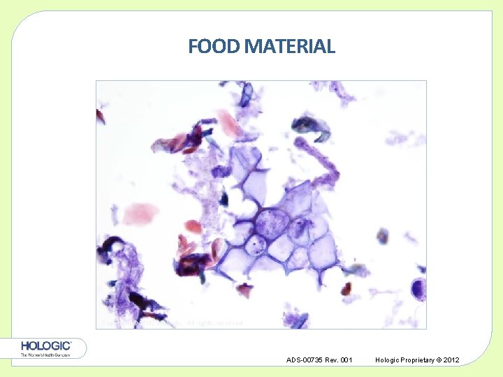 FOOD MATERIAL Copyright © 2012 Hologic, All rights reserved. ADS-00735 Rev. 001 Hologic Proprietary