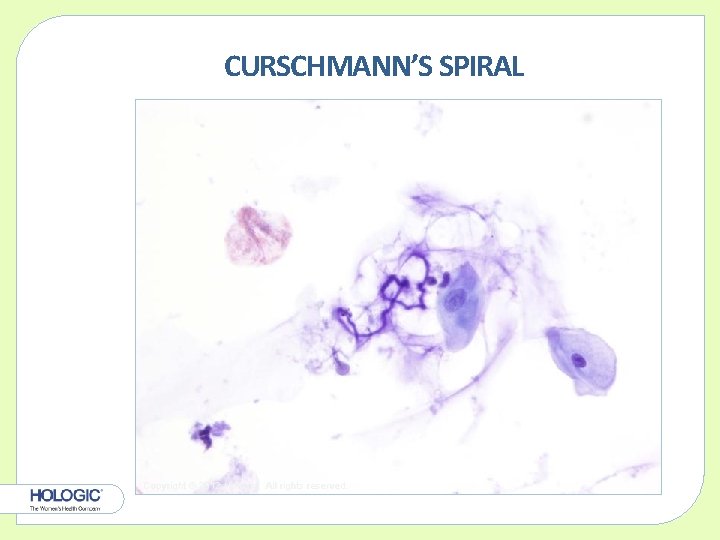 CURSCHMANN’S SPIRAL Copyright © 2012 Hologic, All rights reserved. 