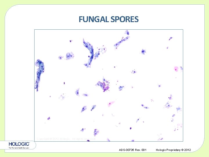FUNGAL SPORES Copyright © 2012 Hologic, All rights reserved. ADS-00735 Rev. 001 Hologic Proprietary