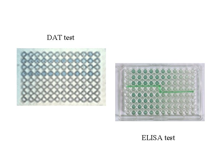 DAT test ELISA test 