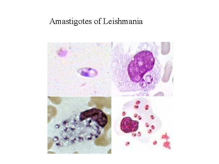 Amastigotes of Leishmania 