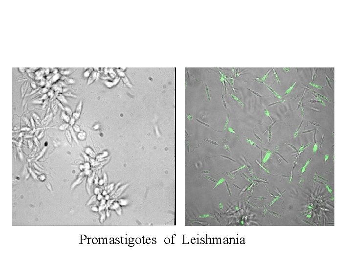 Promastigotes of Leishmania 