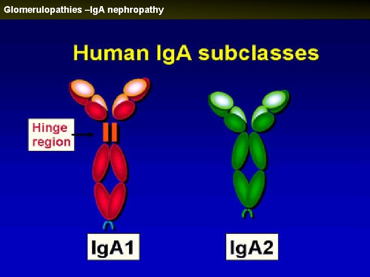 Glomerulopathies –Ig. A nephropathy 