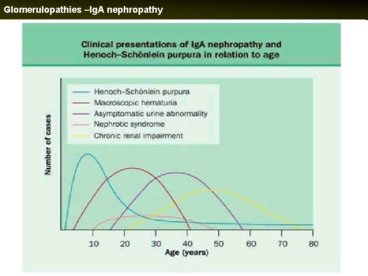 Glomerulopathies –Ig. A nephropathy 