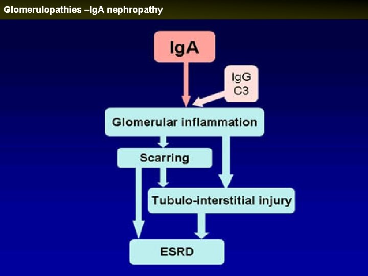 Glomerulopathies –Ig. A nephropathy 