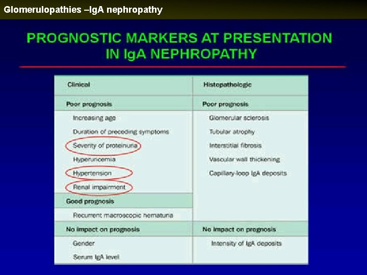 Glomerulopathies –Ig. A nephropathy 