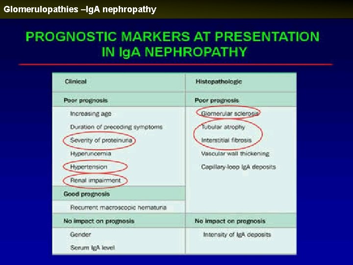 Glomerulopathies –Ig. A nephropathy 