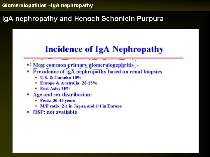 Glomerulopathies –Ig. A nephropathy and Henoch Schonlein Purpura 
