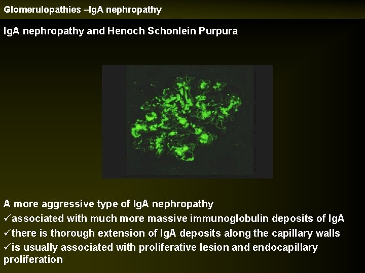 Glomerulopathies –Ig. A nephropathy and Henoch Schonlein Purpura A more aggressive type of Ig.