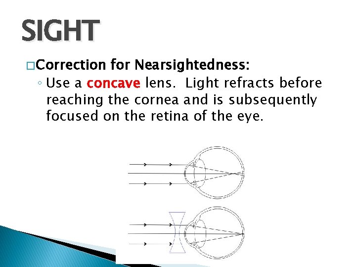 SIGHT � Correction for Nearsightedness: ◦ Use a concave lens. Light refracts before reaching