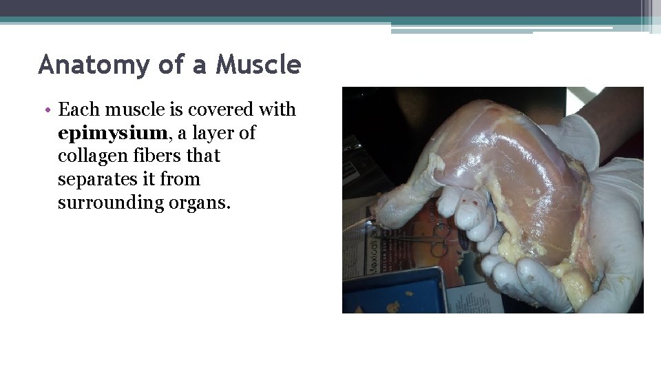 Anatomy of a Muscle • Each muscle is covered with epimysium, a layer of