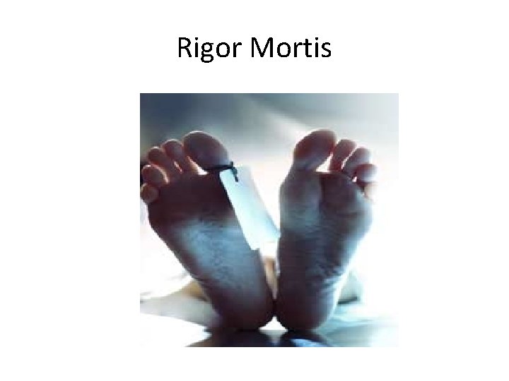 Rigor Mortis 