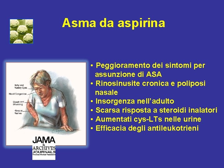 Asma da aspirina • Peggioramento dei sintomi per assunzione di ASA • Rinosinusite cronica