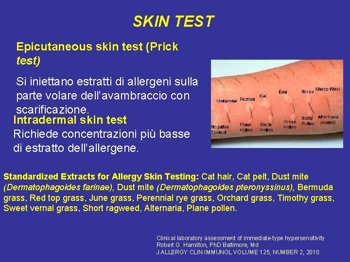 SKIN TEST Epicutaneous skin test (Prick test) Si iniettano estratti di allergeni sulla parte