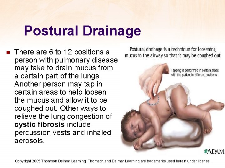 Postural Drainage n There are 6 to 12 positions a person with pulmonary disease