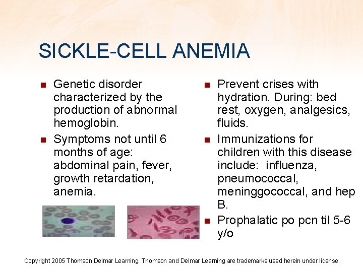 SICKLE-CELL ANEMIA n n Genetic disorder characterized by the production of abnormal hemoglobin. Symptoms