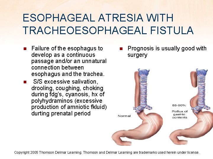 ESOPHAGEAL ATRESIA WITH TRACHEOESOPHAGEAL FISTULA n n Failure of the esophagus to develop as