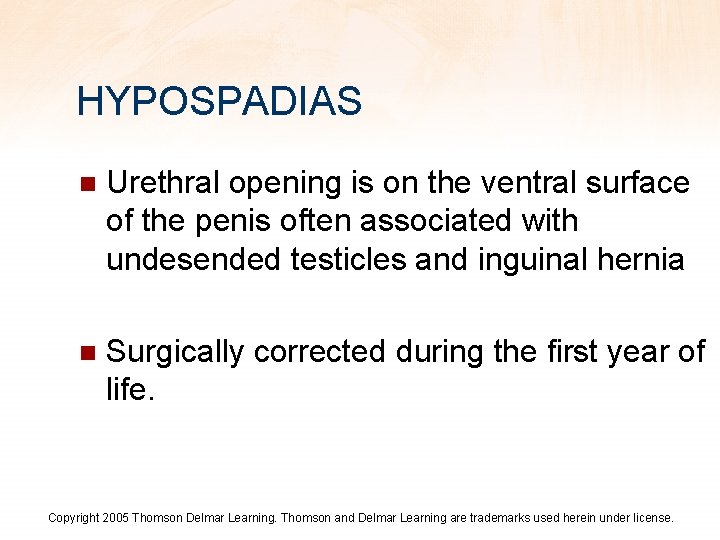 HYPOSPADIAS n Urethral opening is on the ventral surface of the penis often associated